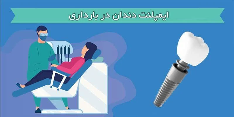ایمپلنت دندان در بارداری