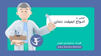 لیست بهترین برند ایمپلنت