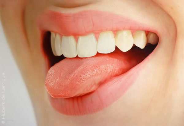 آیا سرطان دهان کشنده است؟, اشکال مختلف سرطان دهان, سرطان دهان