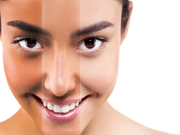 برای روشن شدن پوستم چه کنم؟