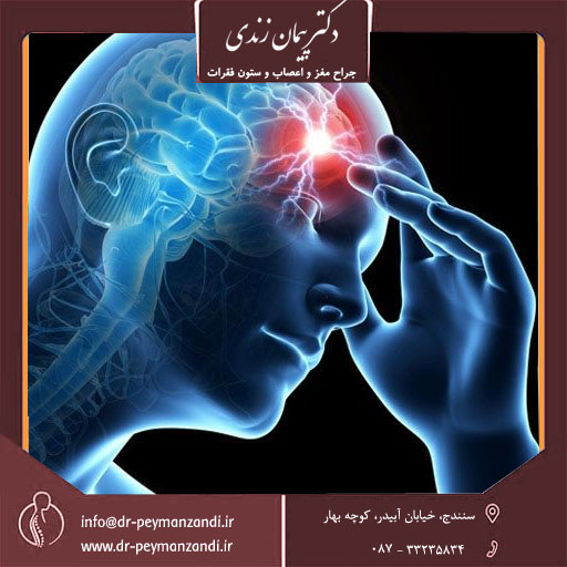  جراح مغز و اعصاب سنندج 