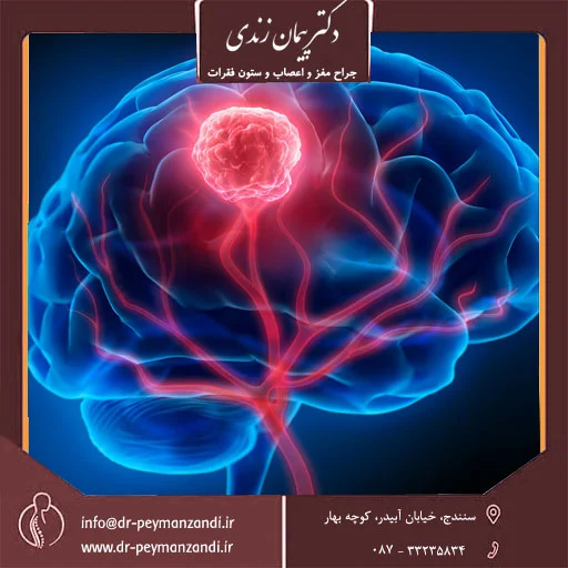 جراح ستون فقرات