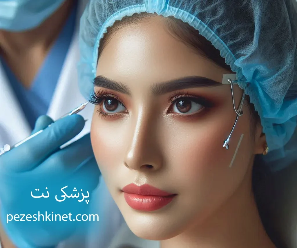 چگونه بهترین دکتر بلفاروپلاستی در انتخاب کنیم؟