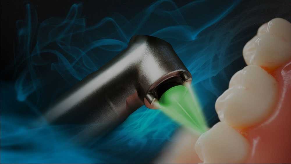 Dental Laser