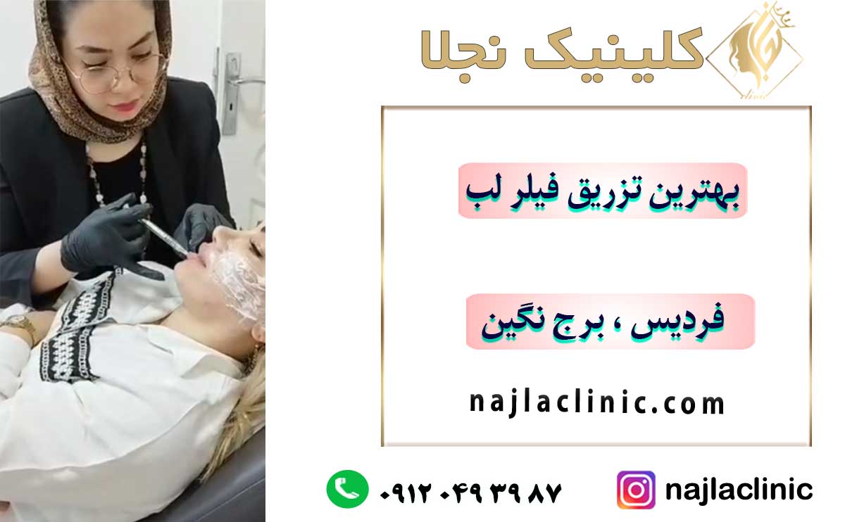 تزریق فیلر لب در فردیس