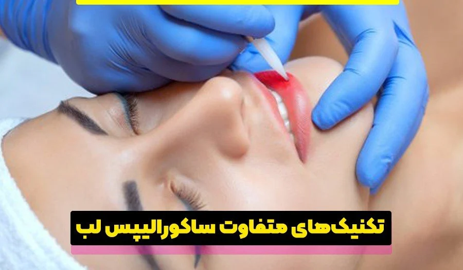 انواع تکنیک های ساکورالیپس لب