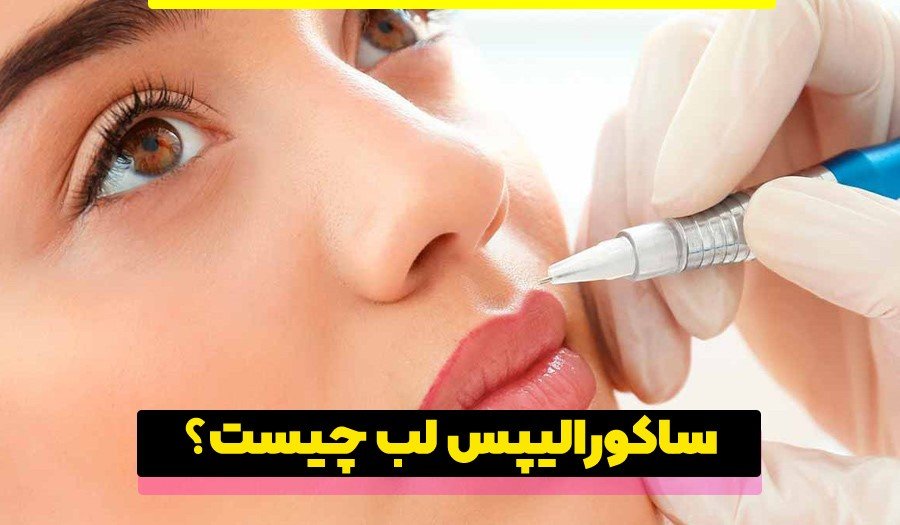 ساکورالیپس لب چیست؟