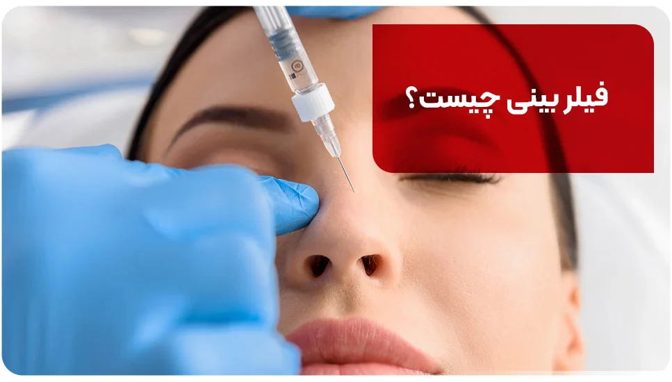 فیلر بینی چیست؟
