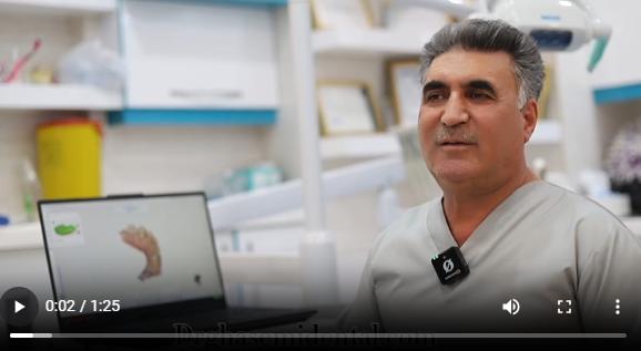 ایمپلنت دیجیتال دکتر قاسمی