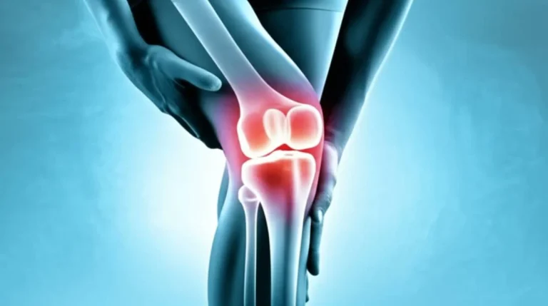 خلاصه کتاب زانو درد پری رضوی یام – راهنمای جامع