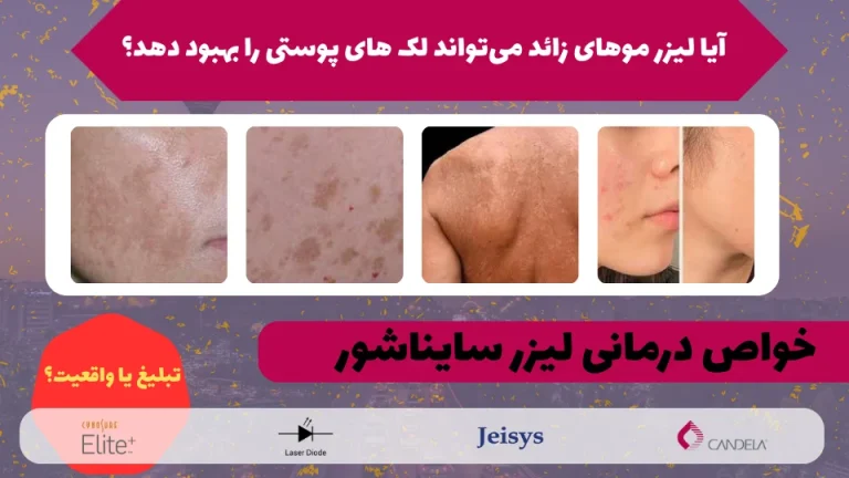 بهترین کلینیک لیزر سعادت  آباد و تهران + آدرس و قیمت و عکس نمونه کار