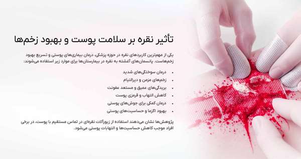 خواص ضد التهابی نقره