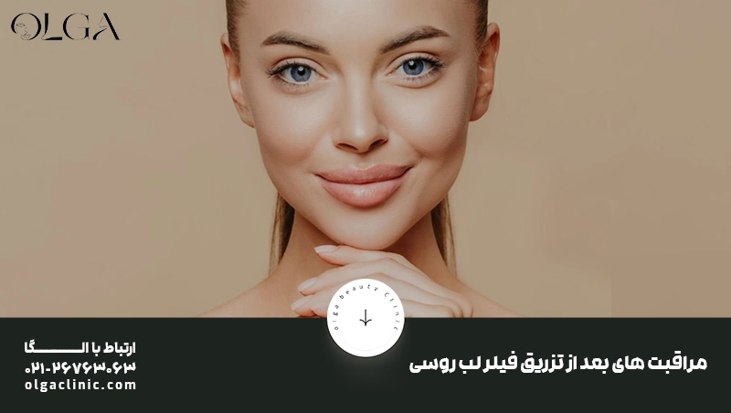مراقبت های بعد از تزریق فیلر لب روسی